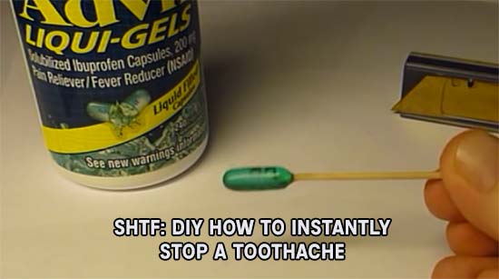 DIY-How-To-Instantly-Stop-A-Toothache.jp