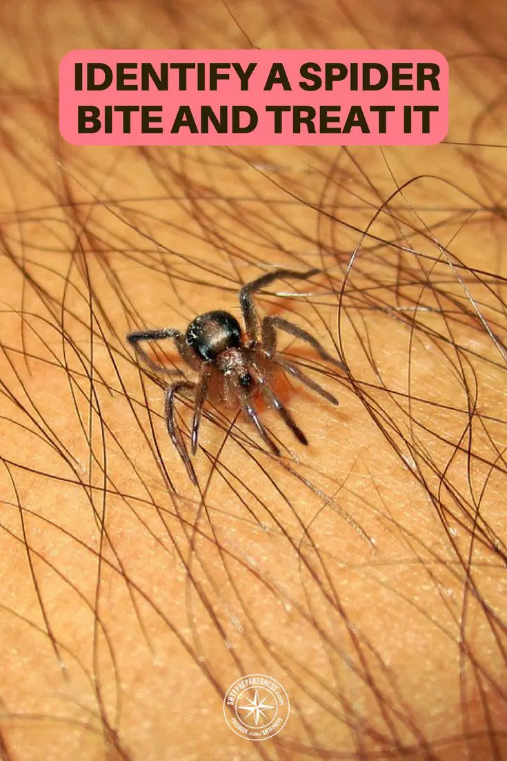How To Identify A Spider Bite And Treat It Spider Bit