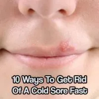 10 Ways To Get Rid Of A Cold Sore Fast - Check out these awesome 10 Ways To Get Rid Of A Cold Sore Fast. All of the methods are natural and you probably have them laying around the house.
