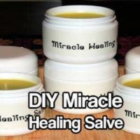 DIY Miracle Healing Salve — Healing Salves have been used to treat wounds and promote healing on every continent and by every culture for thousands of years. Even in modern medicine, different types of salves are used to treat burns (aloe based gels), keep infection down and promote healing (antibacterial ointments), and correct skin conditions (eczema, psoriasis).