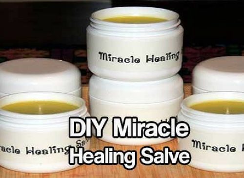 DIY Miracle Healing Salve — Healing Salves have been used to treat wounds and promote healing on every continent and by every culture for thousands of years. Even in modern medicine, different types of salves are used to treat burns (aloe based gels), keep infection down and promote healing (antibacterial ointments), and correct skin conditions (eczema, psoriasis).