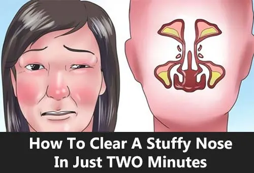 How To Clear A Stuffy Nose In Just TWO Minutes