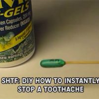 Dentists are scary places to visit, even as an adult, they cause you pain and can cost a fortune if you don't have dental insurance. In modern times people can really get worked up over dental work. Most of which include a numbing needle that makes all the pain disappear.