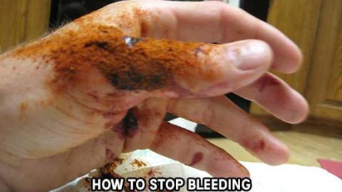 How to Stop Bleeding in an Emergency in 10 Seconds