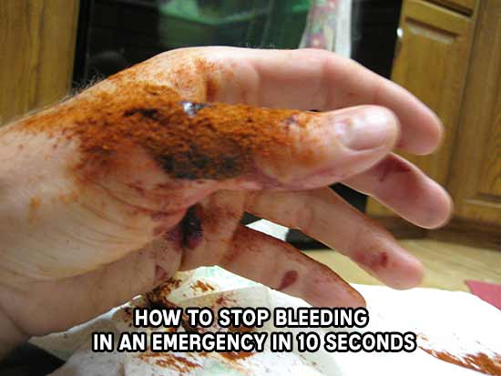How to Stop Bleeding in an Emergency in 10 Seconds 1 How To Stop Bleeding In An Emergency In 10 Seconds -- Among its many health benefits, cayenne pepper is also a great herb for the treating of wounds or lacerations. This may come as bit of a surprise to many. Cayenne pepper however is a multi-faceted herb.