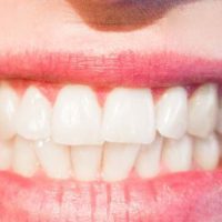 Dental Flaws for the SHTF Prepper — Dental information for the end of the world!