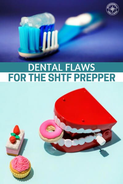 Dental Flaws for the SHTF Prepper — Dental information for the end of the world!