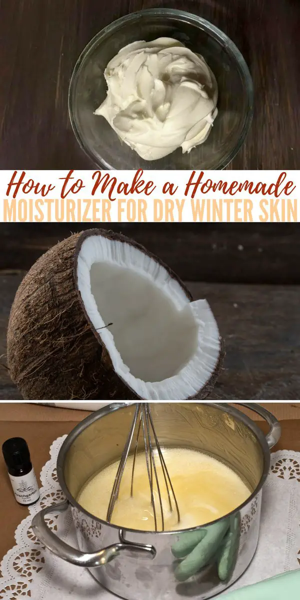 How to Make a Homemade Moisturizer for Dry Winter Skin — Do your heels look like the hide of an alligator? Is your skin chapped from the cold and the wind? Are your legs so dry that little flakes come off with your pants?
