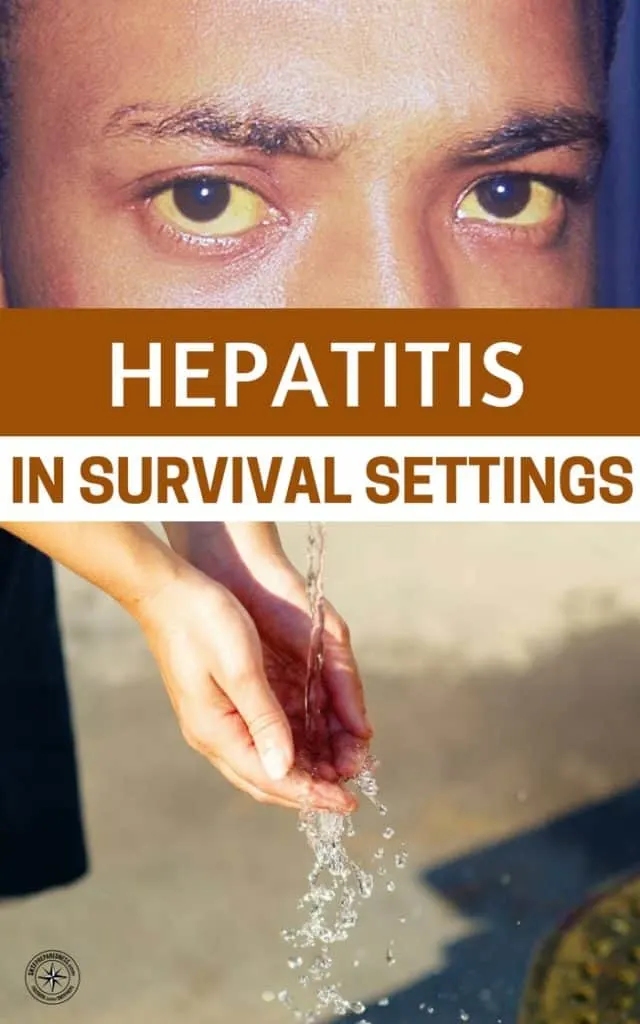 Hepatitis in Survival Settings - Infection is certainly to be expected in a survival series. Its an issue that we really look past in return for preps that are more noticeable and violent.
