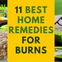 11 home remedies for burns and how to heal them when a doctor is not available.