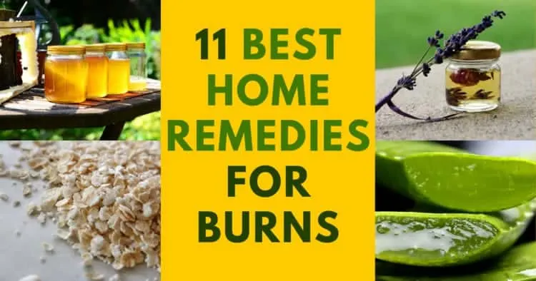 11 home remedies for burns and how to heal them when a doctor is not available.