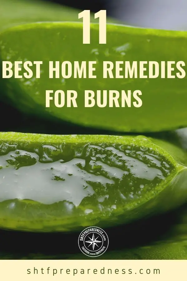 11 of our favorite home remedies for burns for when a doctor is not available in a post-SHTF world.