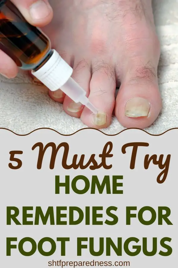 5 must try home remedies for foot fungus. #naturalremedies #homeremedies #footfungus #atheletesfoot #smellyfeet