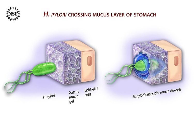 h. pylori bacteria invading the mucus layer of the stomach