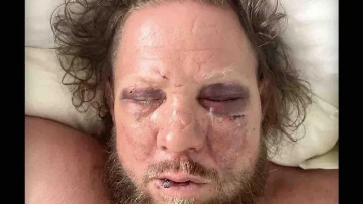 ‘Scumbags’: Man brutally beaten, stomped on at wedding reception by father, son who have extensive violent criminal histories, authorities say