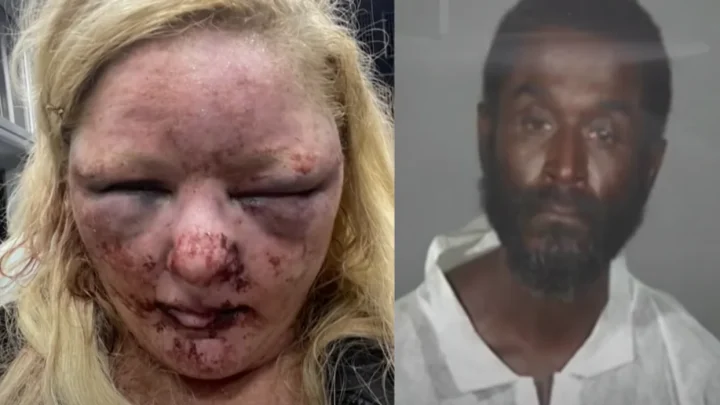 While walking her dogs, LA woman was brutally raped by suspect released from jail hours earlier – survivor recalls trying to bite off attacker’s penis